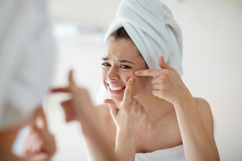 Common Acne Myths