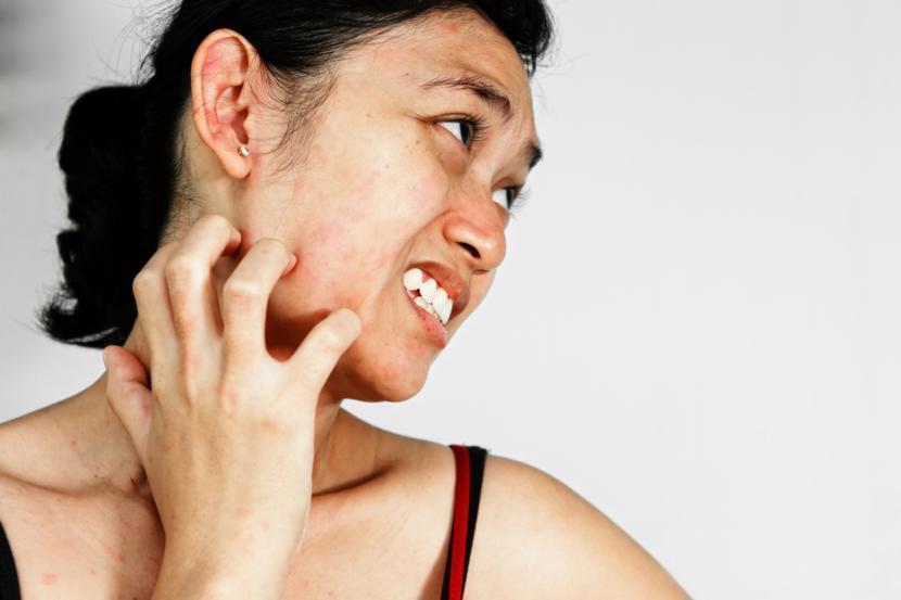 Don't Be a Flake: Tips for Dry Skin