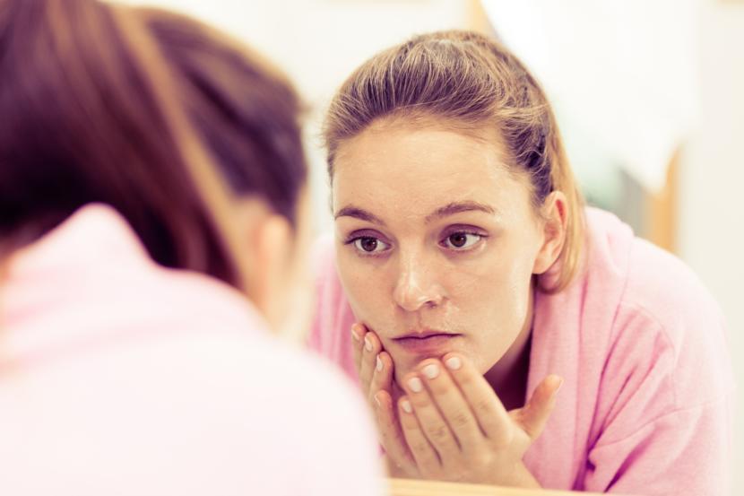 How to Get Rid of Your Acne