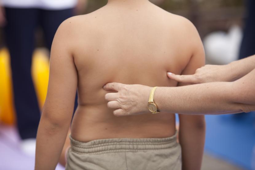 Overweight Children Are Likely to Have High Blood Pressure