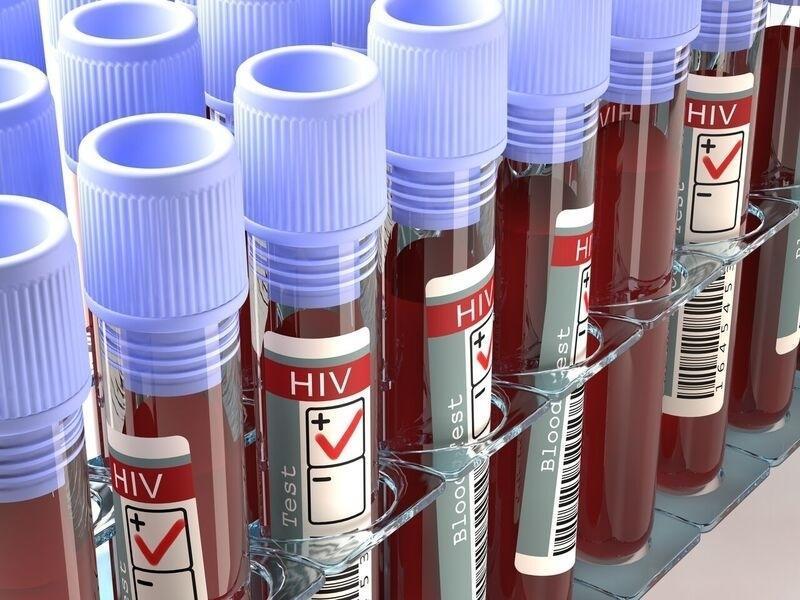 AIDS: Frequently Asked Questions