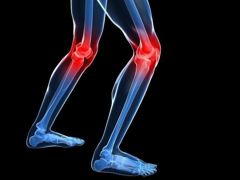 Arthritis May Lead to Obesity