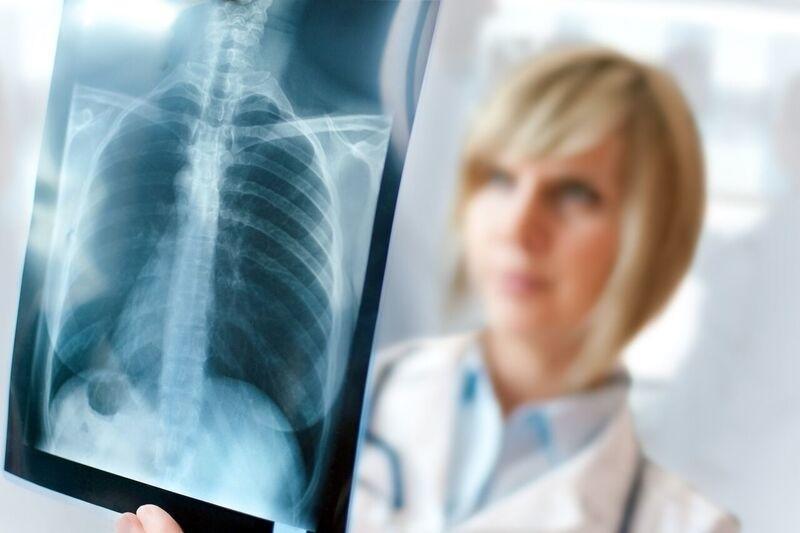 Atelectasis: The Collapse of a Lung or the Lobe