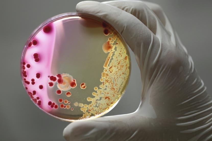 This Oral Bacteria Might Be Partially Responsible for Crohn’s