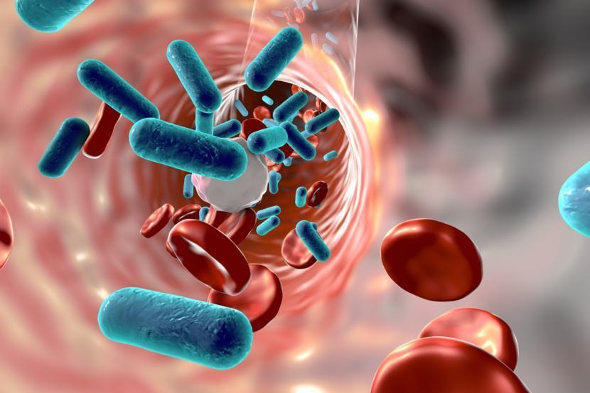 Can You Feel the Symptoms of Sepsis?