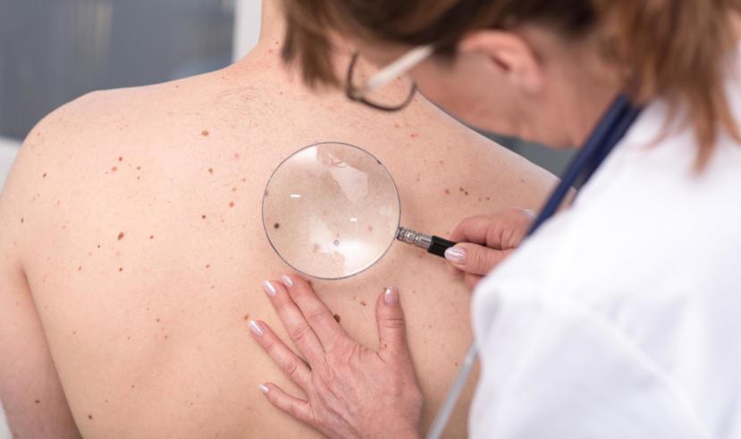 Causes, Treatment, and Prevention of Petechiae
