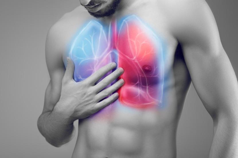 How Cystic Fibrosis Progresses in Patients