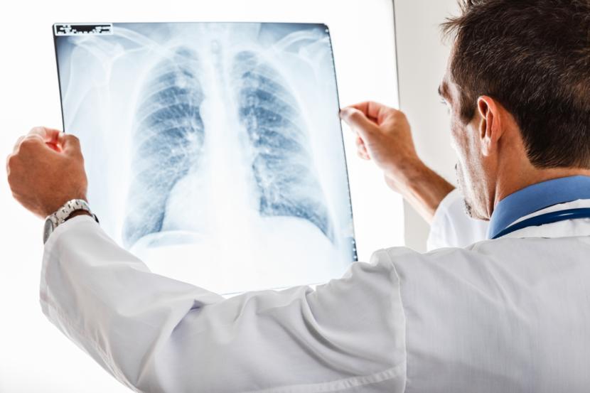 Everything About the Mycoplasma pneumoniae Infection