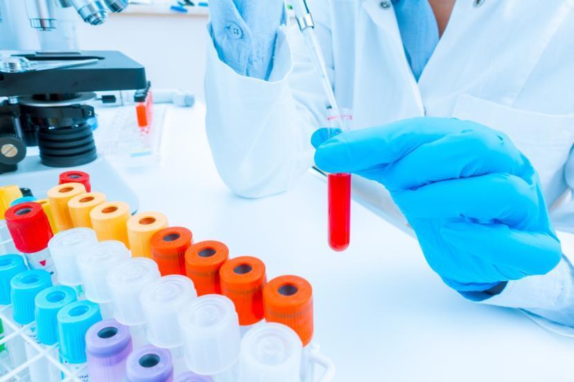 Genetic Markers for Predicting Lupus Susceptibility