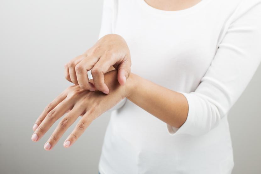 Scabies: 10 Natural Home Remedies for Scabies That Work Fast