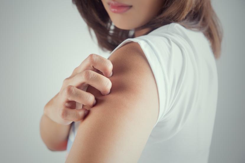 How Common is Lupus, and what Does it Look Like?