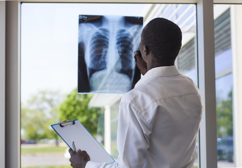 How Lung Transplants for Cystic Fibrosis Patients Have Changed