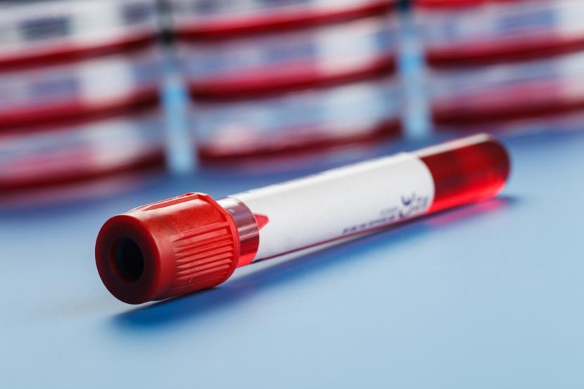 How to Diagnose Crohn's Disease and Colitis Through Blood Tests