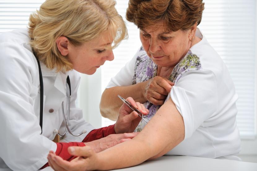 How to Remove a Deer Tick to Prevent from Getting Lyme Disease