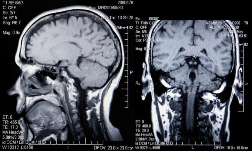 If I Have Recurring Migraines, Who Should I Call?