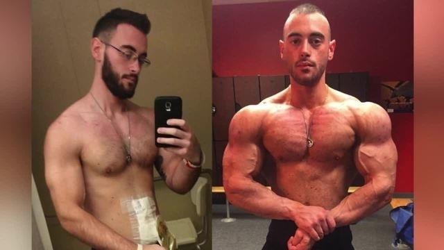 Inspiring Others with Crohn’s Disease through Bodybuilding