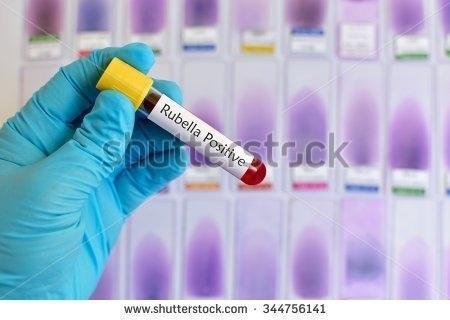 Is MMR (measles, mumps, rubella) vaccine safe for my baby?