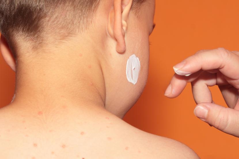 Maculopapular Rash: Symptoms, Causes and Treatment