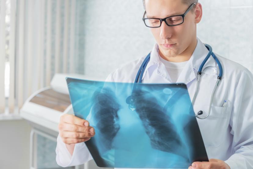 Pneumonia With Lung Cancer: What You Need To Know