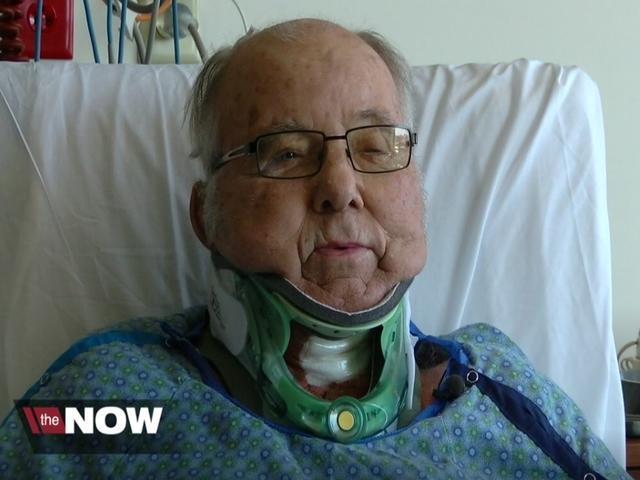 Risky Surgery Gives Man with Rheumatoid Arthritis Ability to Look Up After Decades