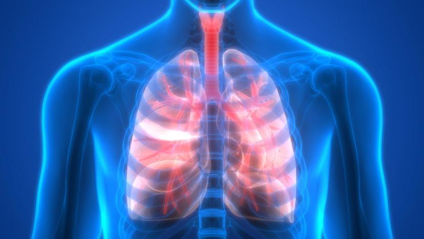 How Does Rheumatoid Arthritis Affect the Lungs?
