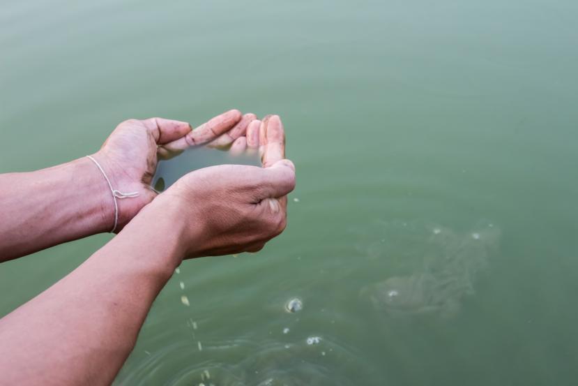 Signs and Symptoms of Cholera