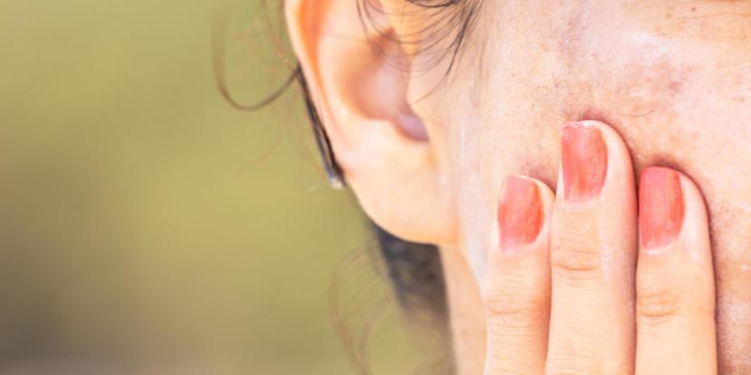 Rare Skin Condition Linked to Crohn’s Disease