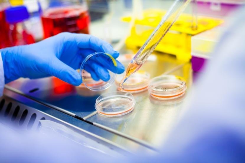 Stem Cell Therapy Can Reduce Inflammation in Cystic Fibrosis, Study Says