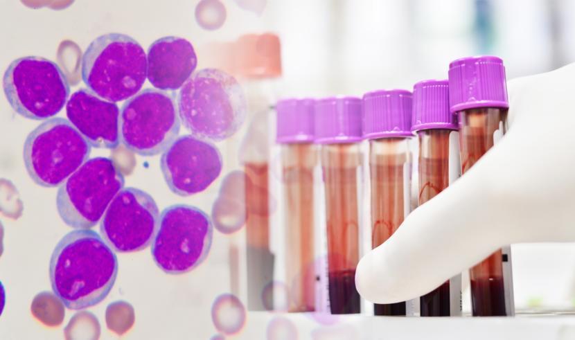 The Leukemia & Lymphoma Society to Expand Mission Against Blood Cancer