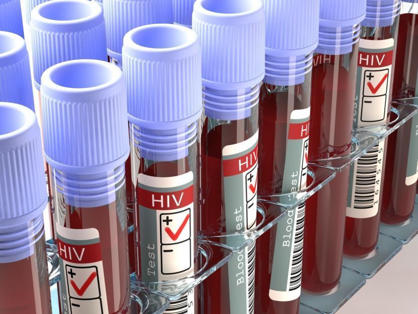 What Causes AIDS?