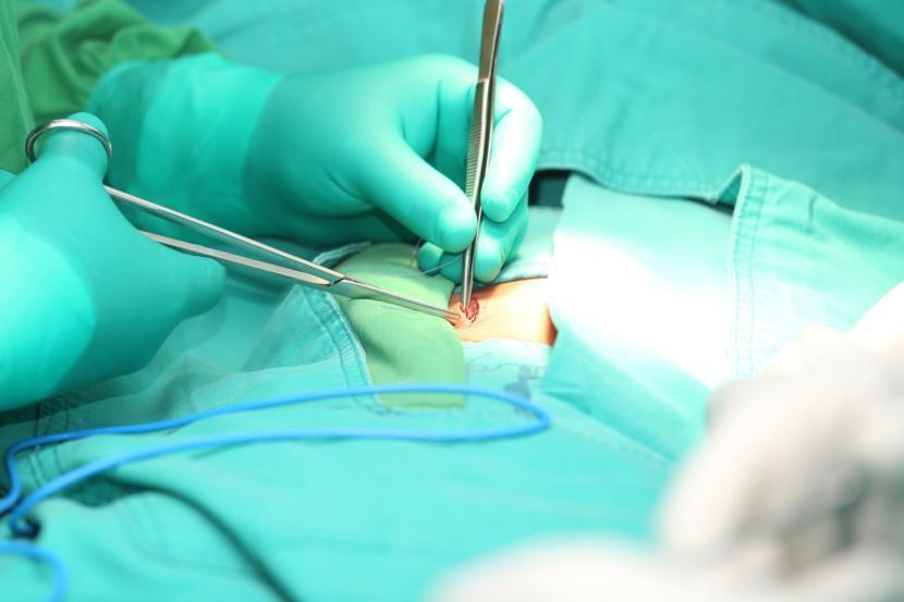 What Happens During an Appendectomy?