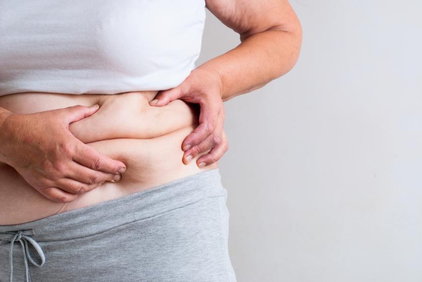 What to Expect After Gastric Bypass Surgery: Results