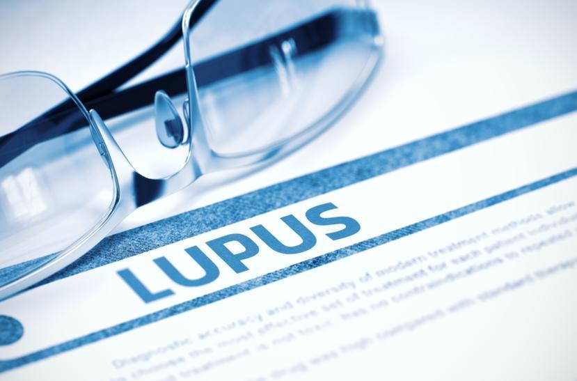 What You Should Know About Neonatal Lupus