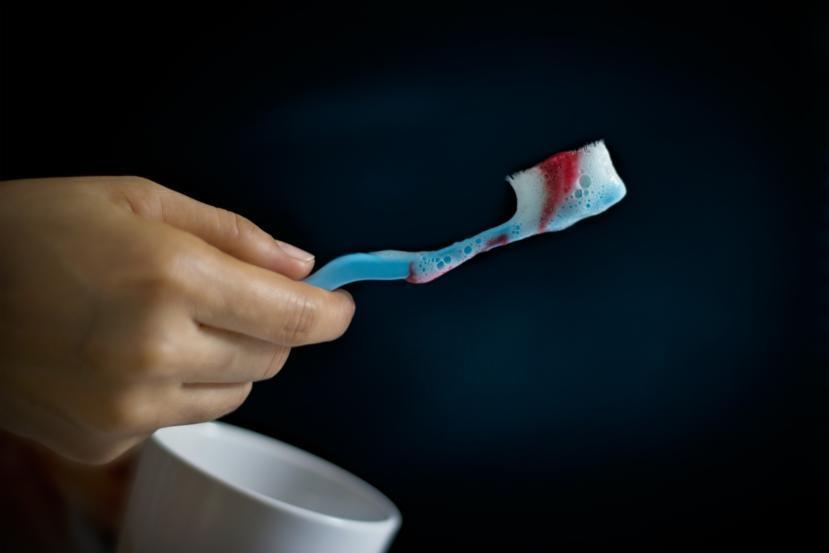 Why are my Gums Bleeding?