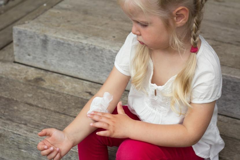 Everything Parents Should Know Before Treating Heat Rash