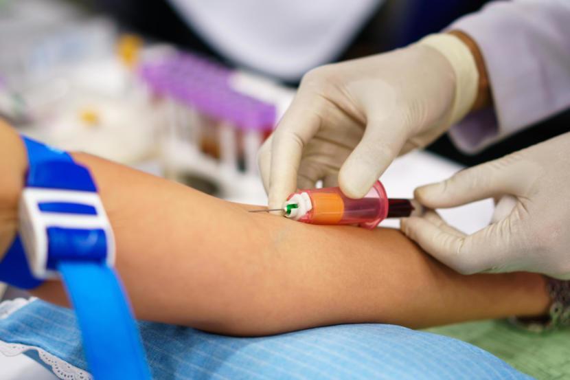 What Is a CPK Lab Test?