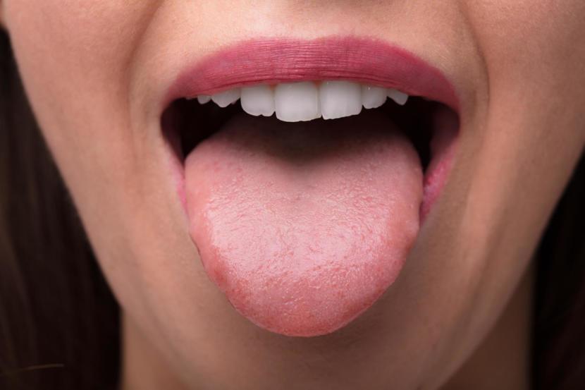 Sore Tongue