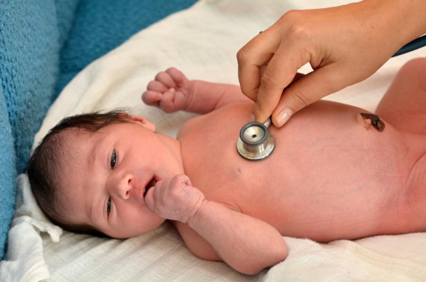 Apgar Score: the five signs evaluated