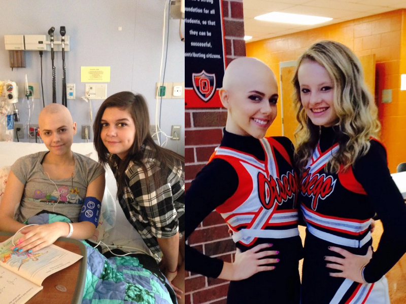 17-year-old Promotes Awareness of Unusual Ovarian Cancer Symptoms