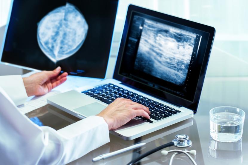 Breast Cancer and Elective Double Mastectomies: A Thing of the Past?