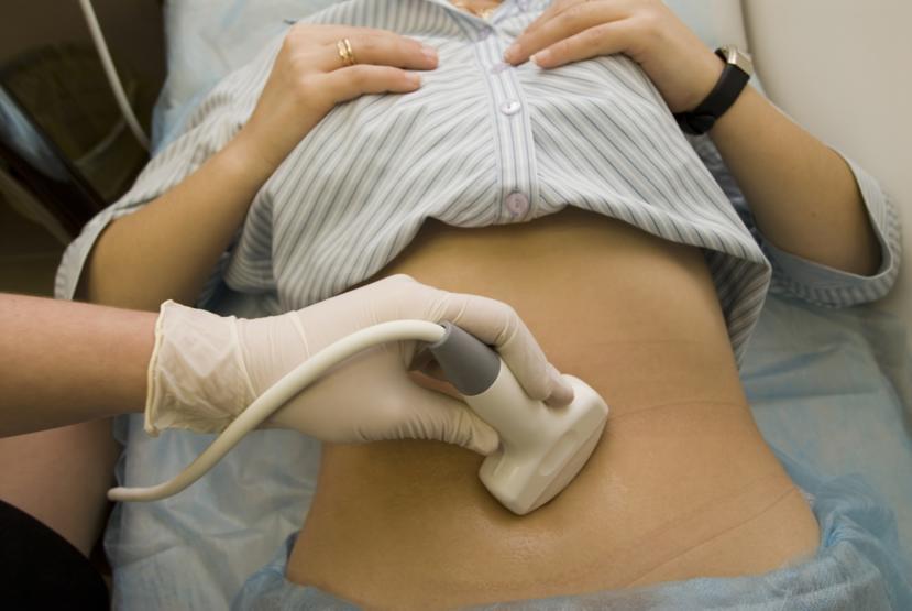 Cancer Answers: Is There a Screening Test for Ovarian Cancer?