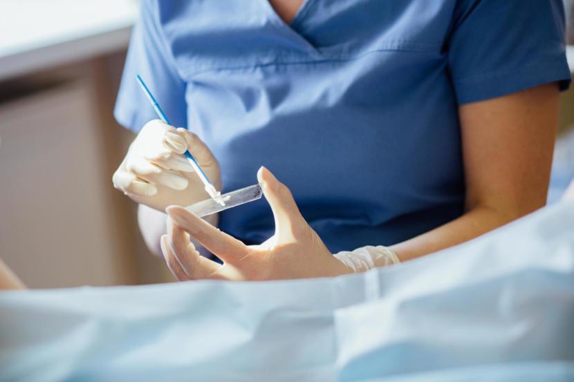 Controversy Surrounds PapSeek, a New Diagnostic Test