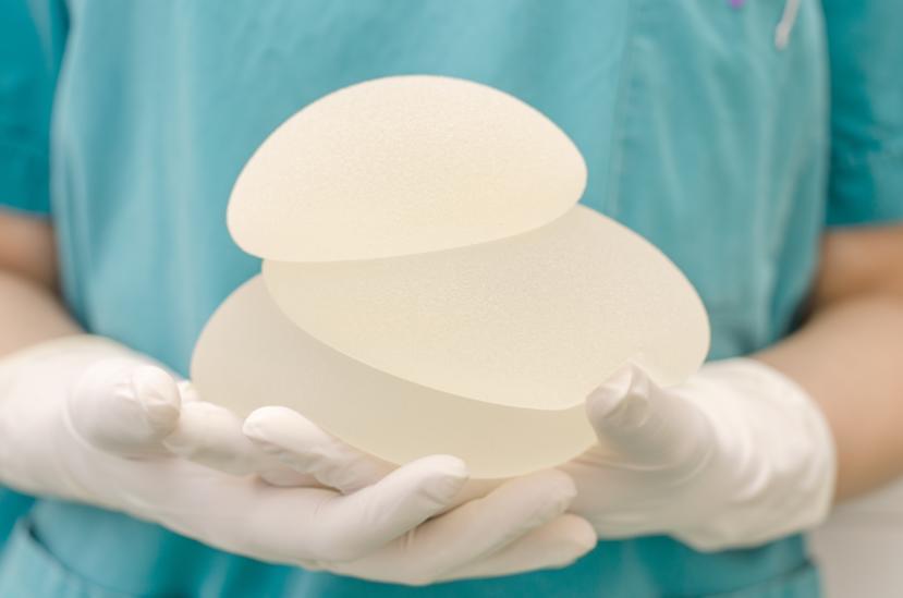 The Link Between Breast Implants and Lymphoma