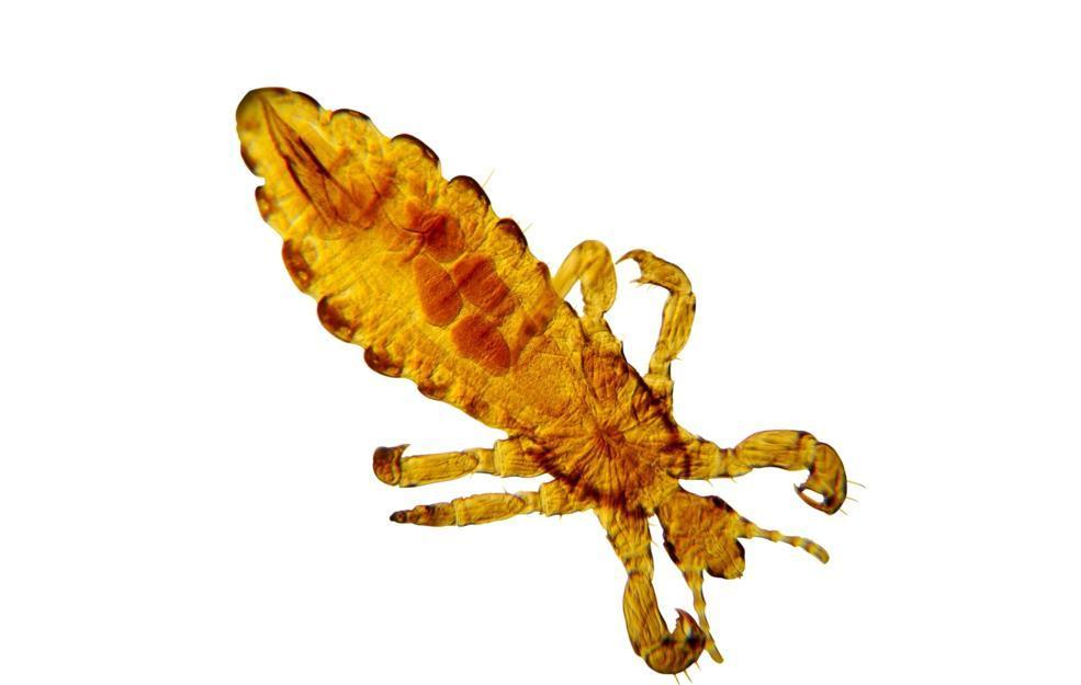 Head Louse
