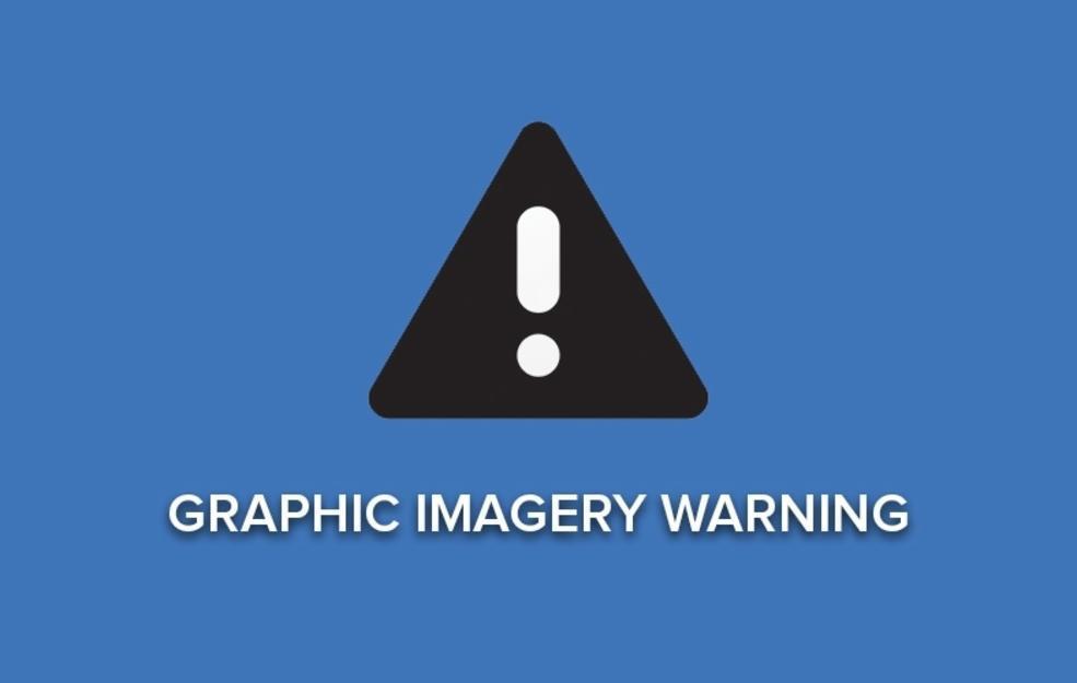 Warning: Graphic content