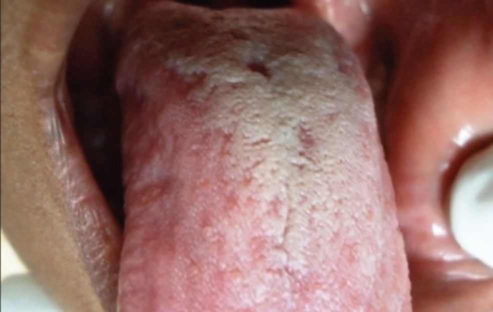 Intestinal Problems