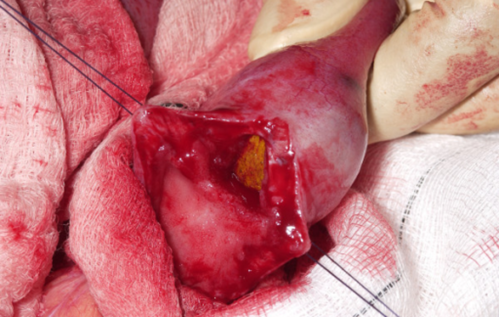 What does the gallbladder do?