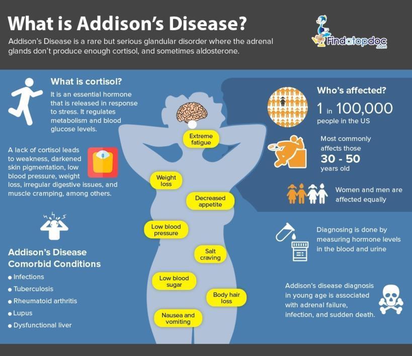 Addison’s Disease