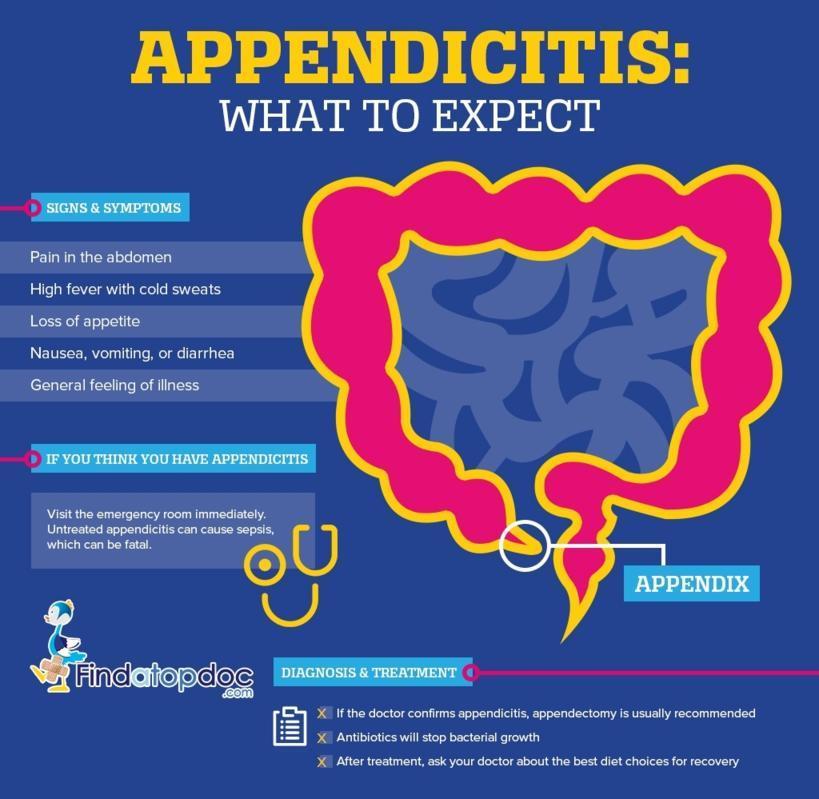 Appendicitis