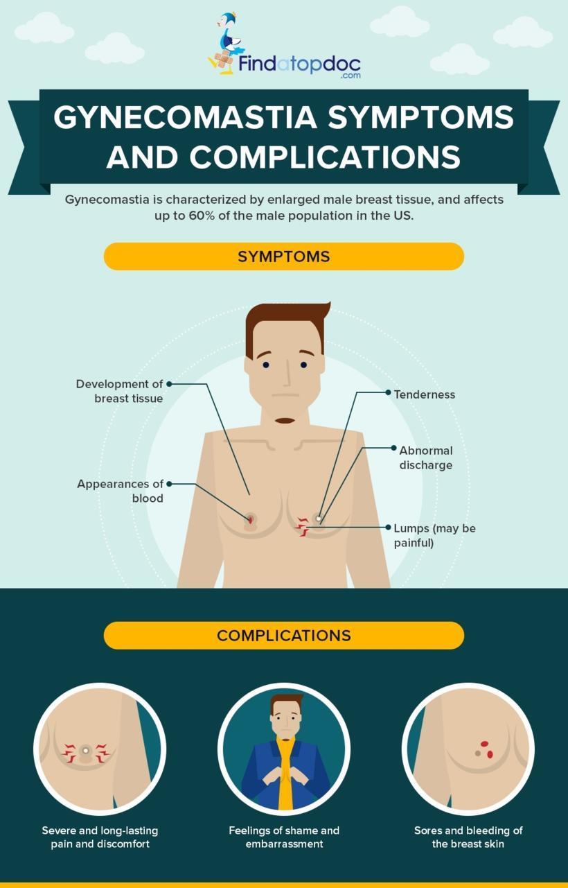 Gynecomastia